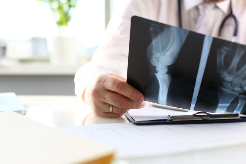 Top 4 Supplements for Bone Health